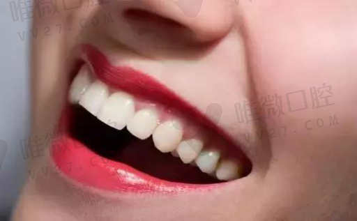贵金属牙和全瓷牙哪个比较好（金属牙和全瓷牙的价格）(图1)